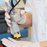 Лазерное удаление кондилом и генитальных бородавок в Кишиневе, Молдове!