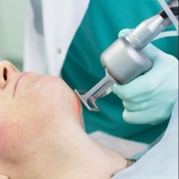 Лазерное удаление шрамов и рубцов Лазерная коррекция дефектов кожи рубцов/шрамов в Кишиневе, Молдове!