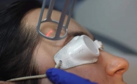 Rejuvenare cu laser a pleoapelor in Moldova Chisinau!